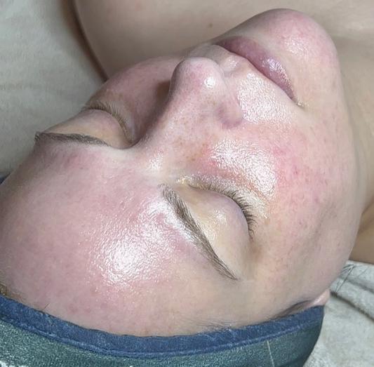 unnamed image